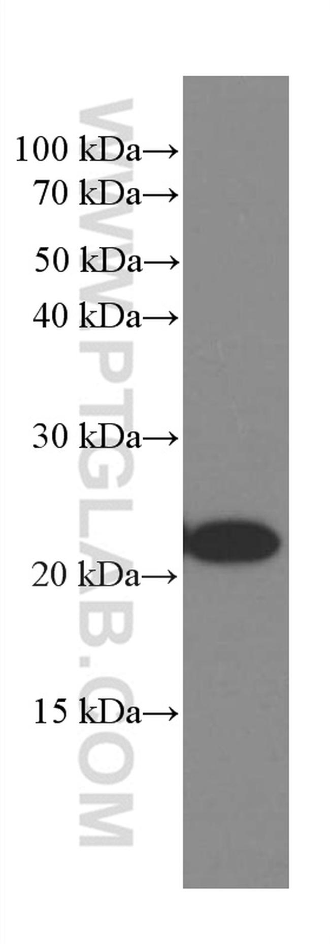 Rac1 Antibody in Western Blot (WB)