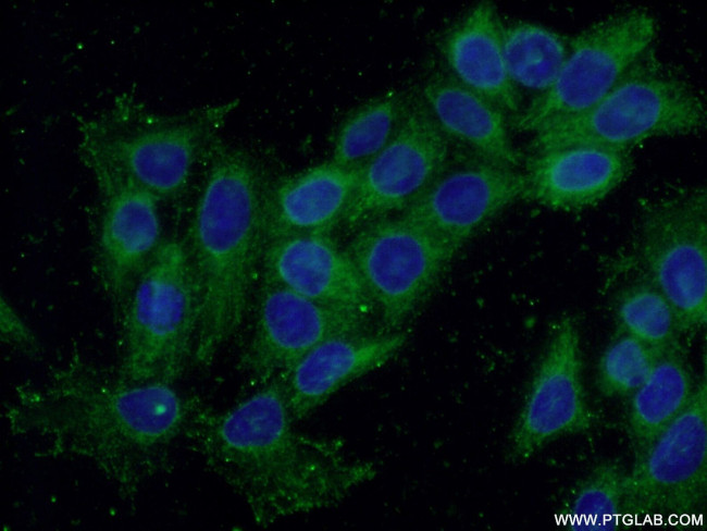 Rac1 Antibody in Immunocytochemistry (ICC/IF)