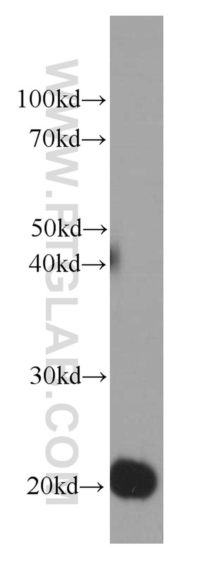 Rac1 Antibody in Western Blot (WB)