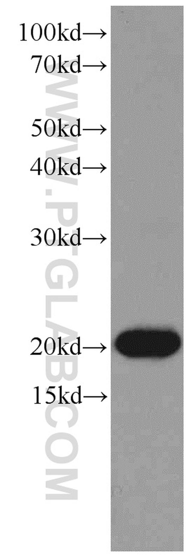 Rac1 Antibody in Western Blot (WB)