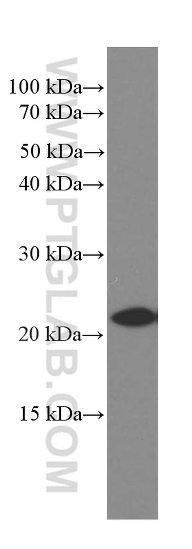 Rac1 Antibody in Western Blot (WB)
