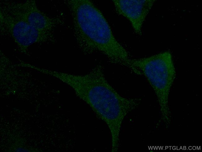 Kininogen 1 Antibody in Immunocytochemistry (ICC/IF)