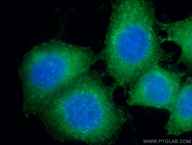 Kininogen 1 Antibody in Immunocytochemistry (ICC/IF)