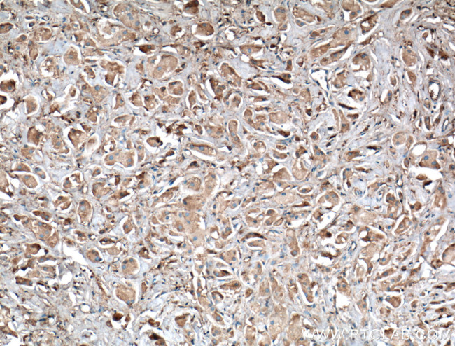 Kininogen 1 Antibody in Immunohistochemistry (Paraffin) (IHC (P))