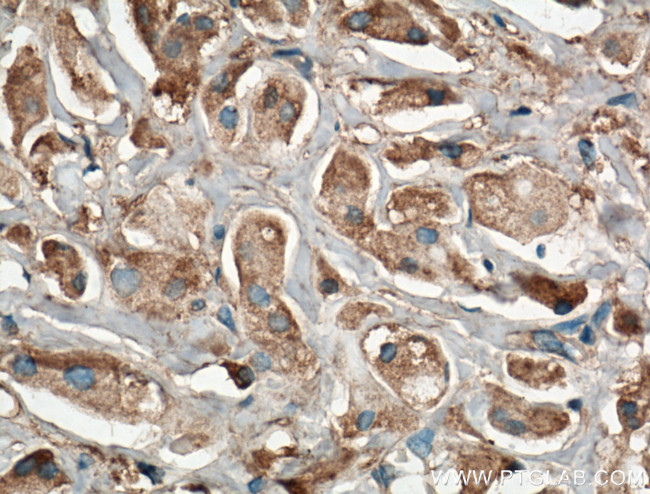 Kininogen 1 Antibody in Immunohistochemistry (Paraffin) (IHC (P))