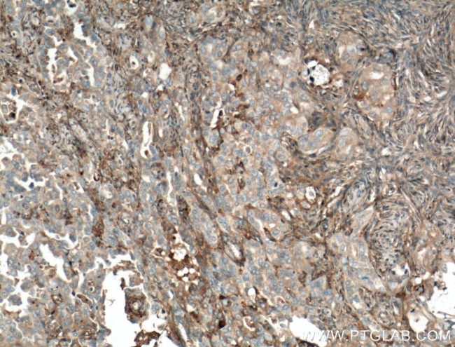 Kininogen 1 Antibody in Immunohistochemistry (Paraffin) (IHC (P))