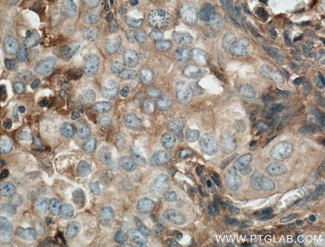 Kininogen 1 Antibody in Immunohistochemistry (Paraffin) (IHC (P))