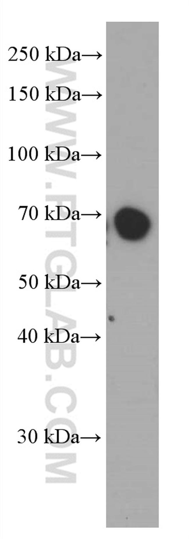 Kininogen 1 Antibody in Western Blot (WB)