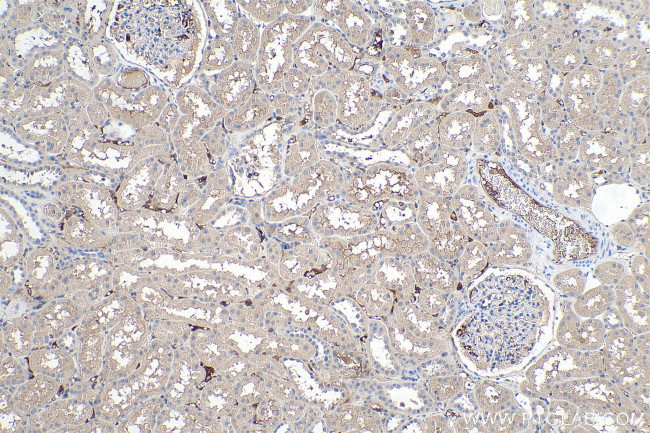 APOL1 Antibody in Immunohistochemistry (Paraffin) (IHC (P))