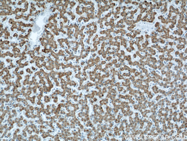 APOL1 Antibody in Immunohistochemistry (Paraffin) (IHC (P))