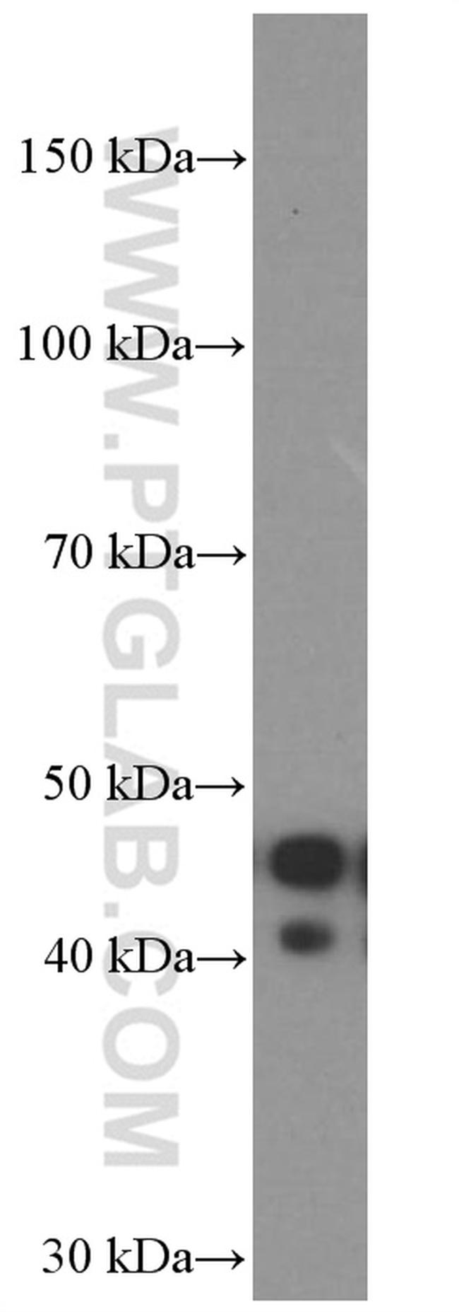 APOL1 Antibody in Western Blot (WB)