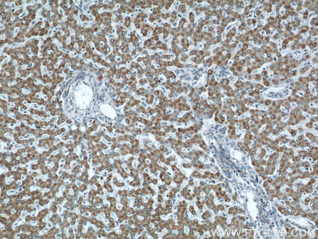 APOL1 Antibody in Immunohistochemistry (Paraffin) (IHC (P))