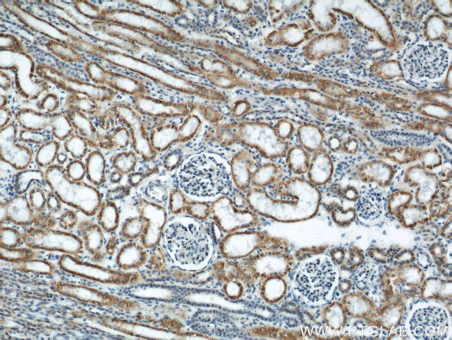 APOL1 Antibody in Immunohistochemistry (Paraffin) (IHC (P))