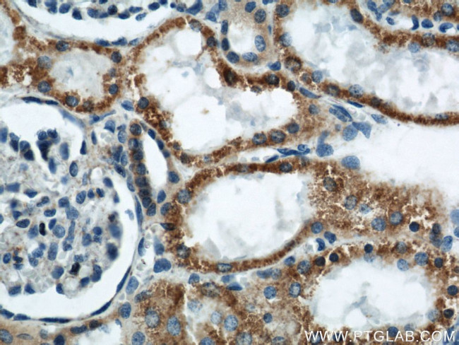 APOL1 Antibody in Immunohistochemistry (Paraffin) (IHC (P))