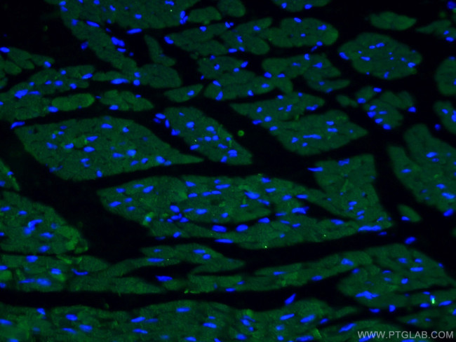 ACTC1 Antibody in Immunohistochemistry (PFA fixed) (IHC (PFA))