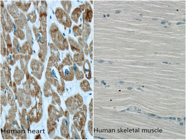 ACTC1 Antibody in Immunohistochemistry (Paraffin) (IHC (P))