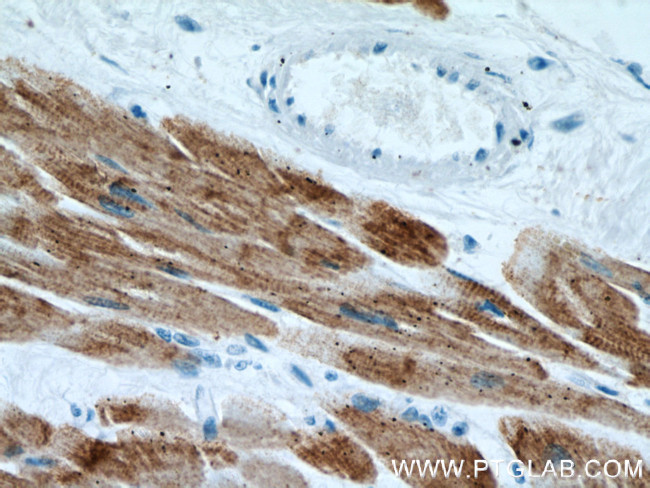 ACTC1 Antibody in Immunohistochemistry (Paraffin) (IHC (P))