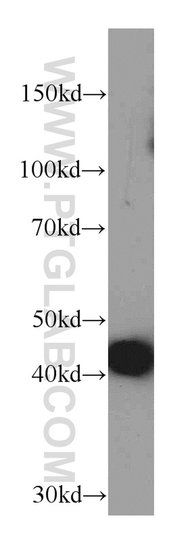 ACTC1 Antibody in Western Blot (WB)