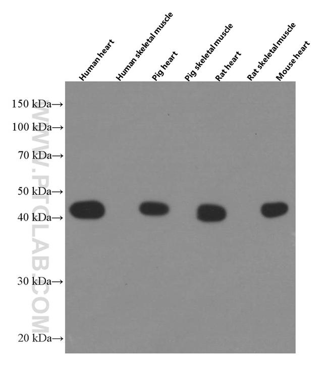 ACTC1 Antibody in Western Blot (WB)