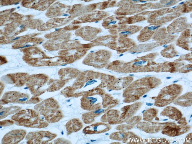 ACTC1 Antibody in Immunohistochemistry (Paraffin) (IHC (P))