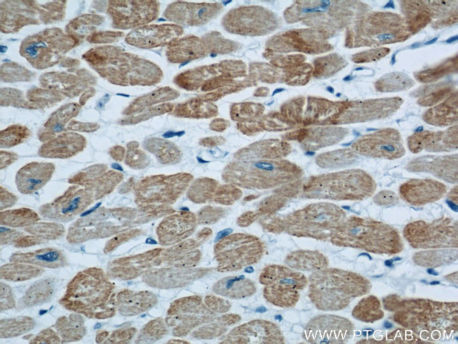 ACTC1 Antibody in Immunohistochemistry (Paraffin) (IHC (P))