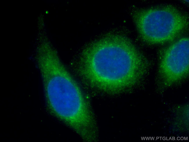 Alpha-2-macroglobulin Antibody in Immunocytochemistry (ICC/IF)