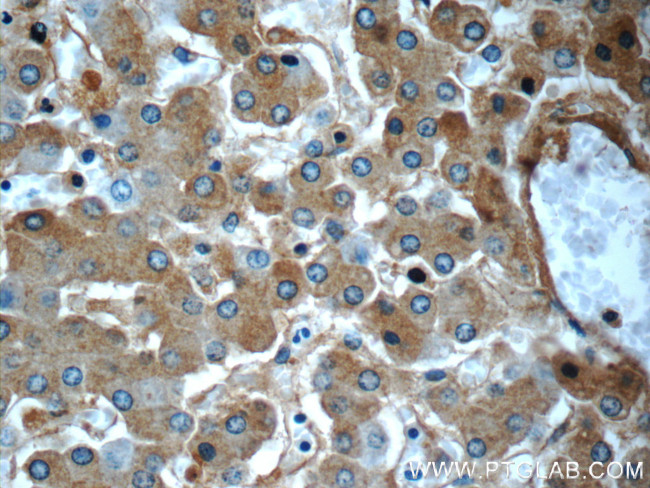 Alpha-2-macroglobulin Antibody in Immunohistochemistry (Paraffin) (IHC (P))