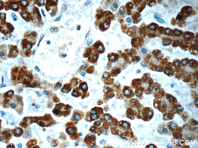 AK2 Antibody in Immunohistochemistry (Paraffin) (IHC (P))