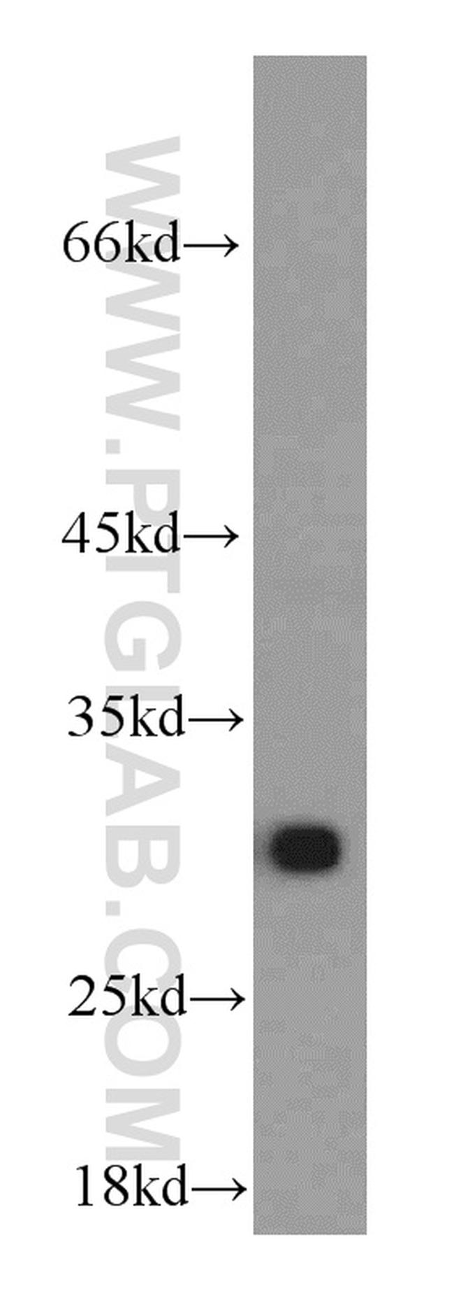 AK2 Antibody in Western Blot (WB)