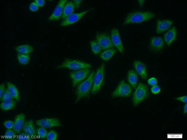 AK2 Antibody in Immunocytochemistry (ICC/IF)