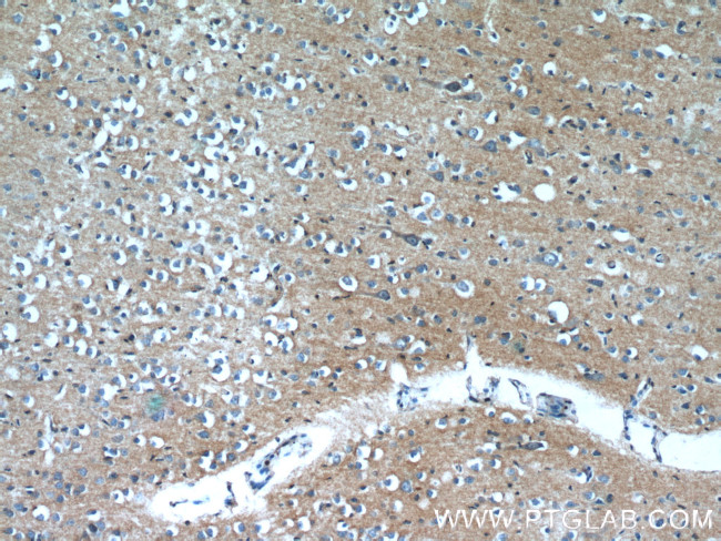 OXA1L Antibody in Immunohistochemistry (Paraffin) (IHC (P))