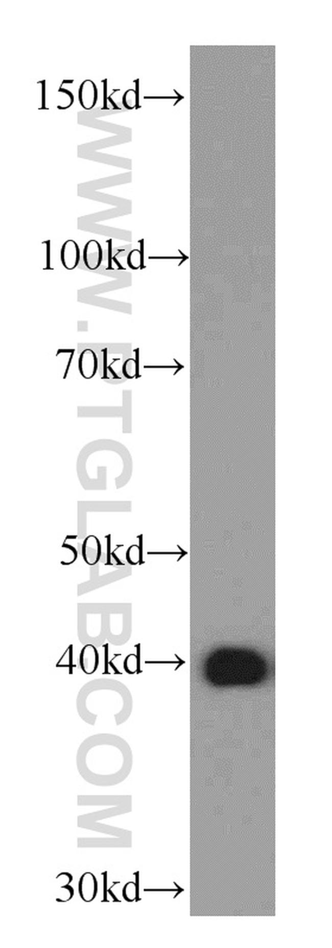 OXA1L Antibody in Western Blot (WB)