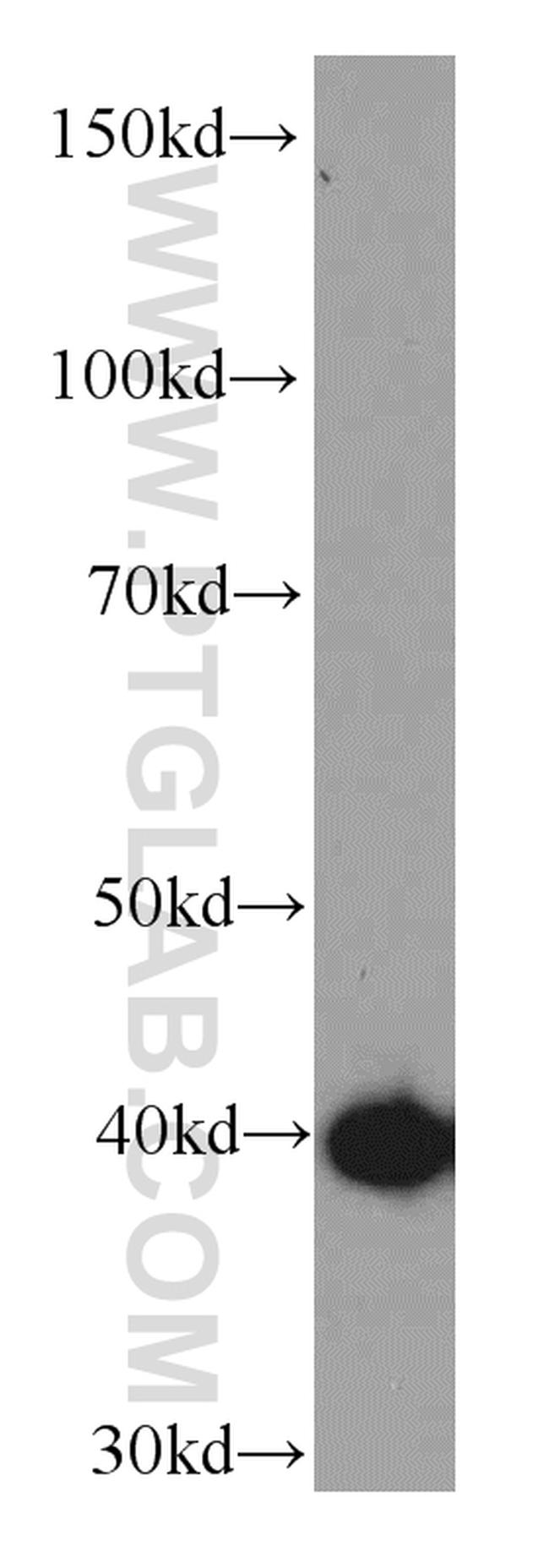 OXA1L Antibody in Western Blot (WB)