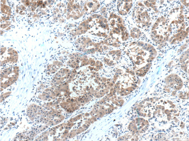 ARG1 Antibody in Immunohistochemistry (Paraffin) (IHC (P))