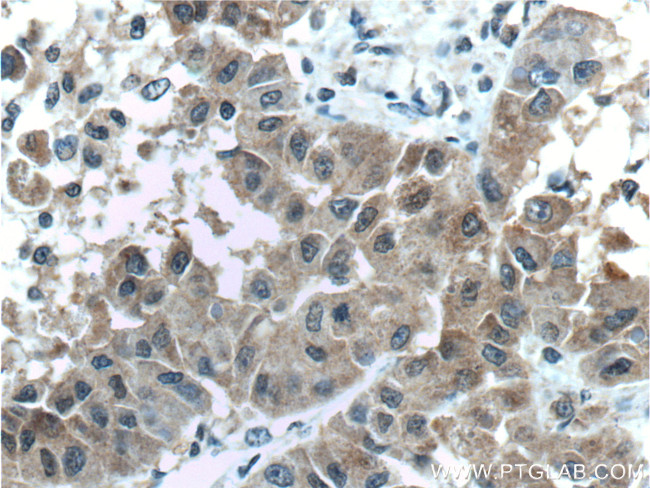 ARG1 Antibody in Immunohistochemistry (Paraffin) (IHC (P))