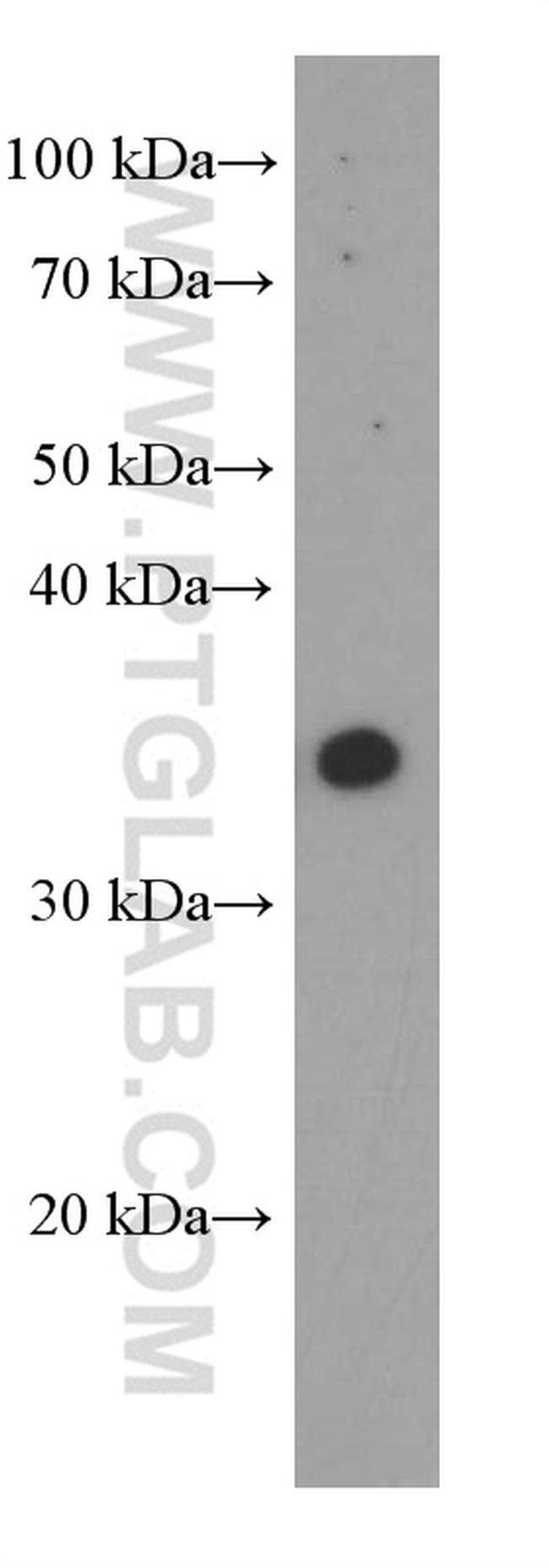 ARG1 Antibody in Western Blot (WB)