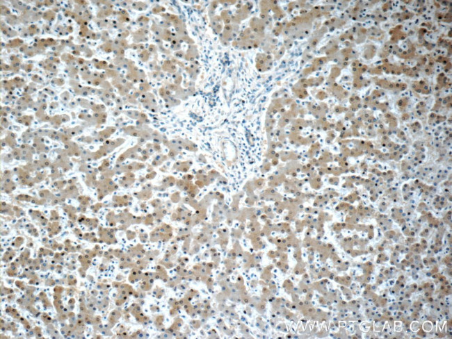 ARG1 Antibody in Immunohistochemistry (Paraffin) (IHC (P))