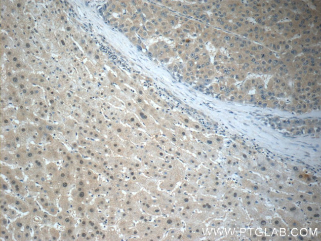 ARG1 Antibody in Immunohistochemistry (Paraffin) (IHC (P))