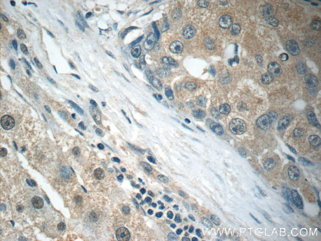 ARG1 Antibody in Immunohistochemistry (Paraffin) (IHC (P))