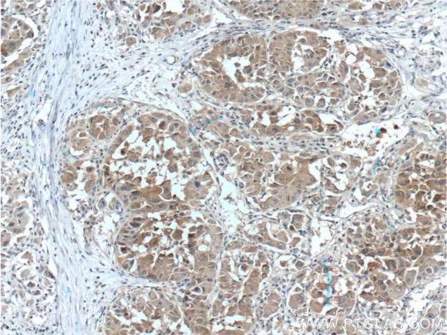 ARG1 Antibody in Immunohistochemistry (Paraffin) (IHC (P))