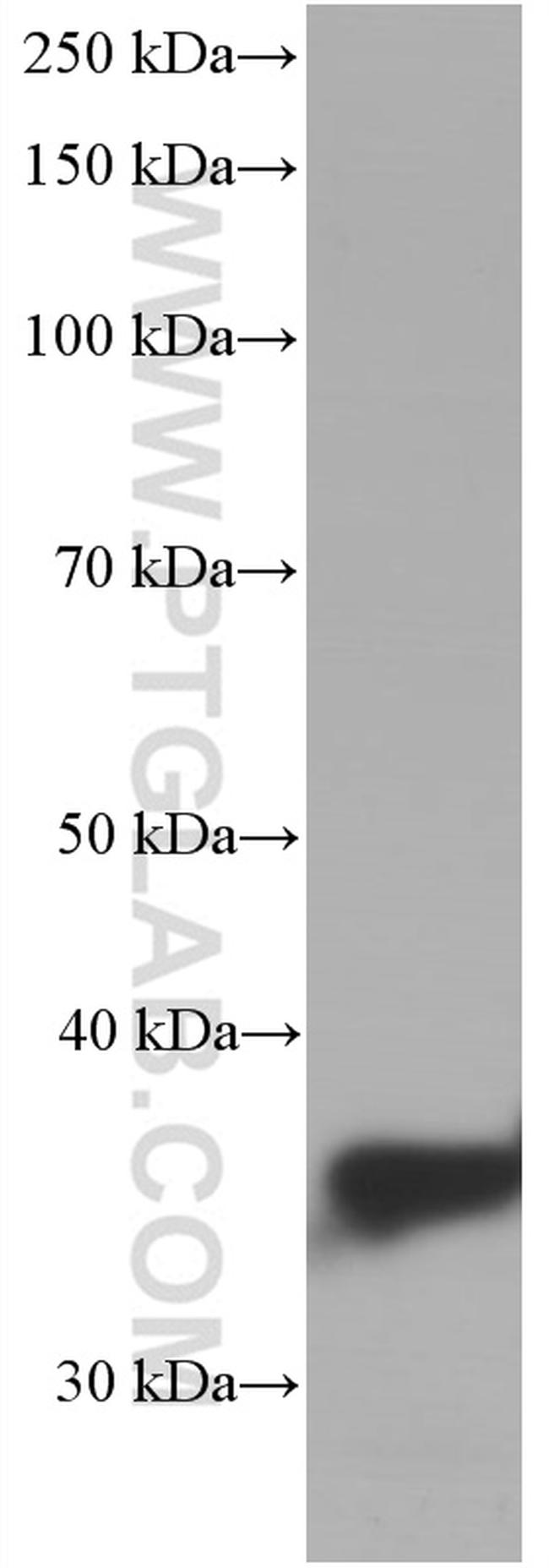 ARG1 Antibody in Western Blot (WB)