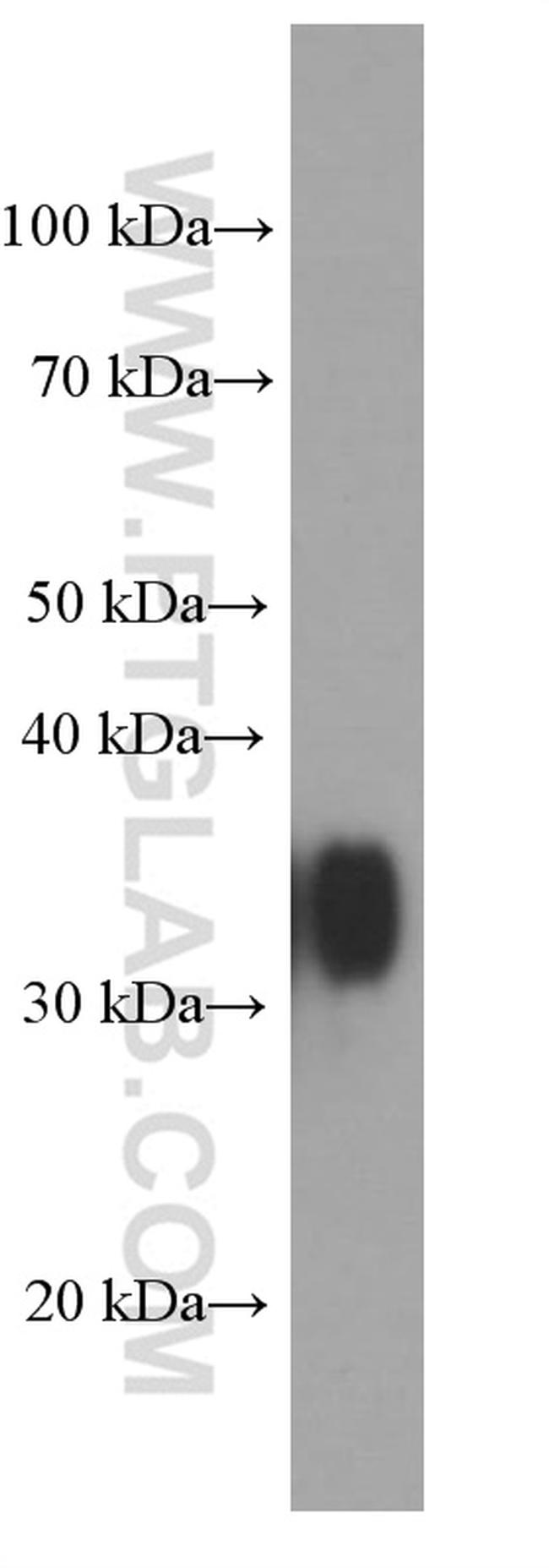 ARG1 Antibody in Western Blot (WB)