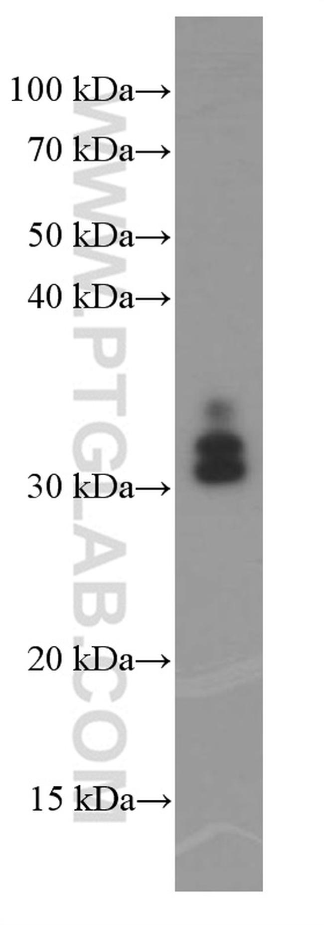 ARG1 Antibody in Western Blot (WB)