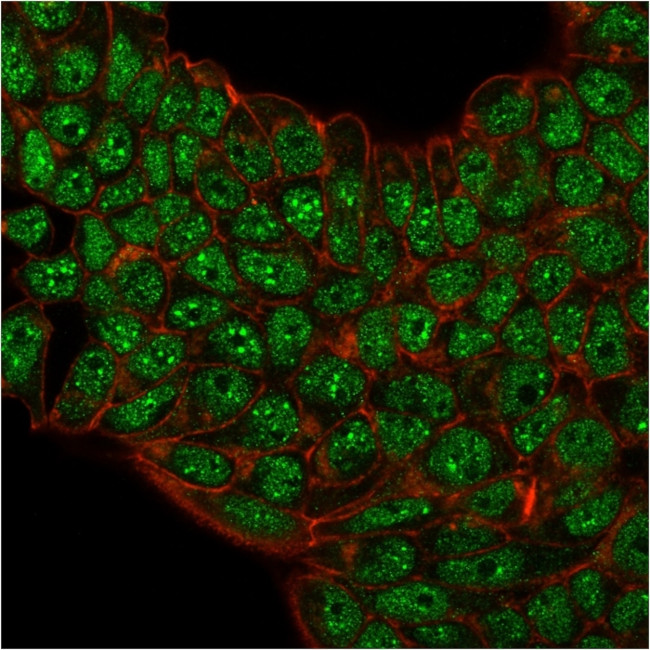 SUMO-2/3 Antibody in Immunocytochemistry (ICC/IF)