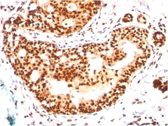 SUMO-2/3 Antibody in Immunohistochemistry (Paraffin) (IHC (P))