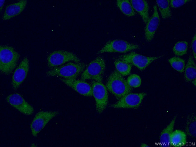 RPL3 Antibody in Immunocytochemistry (ICC/IF)