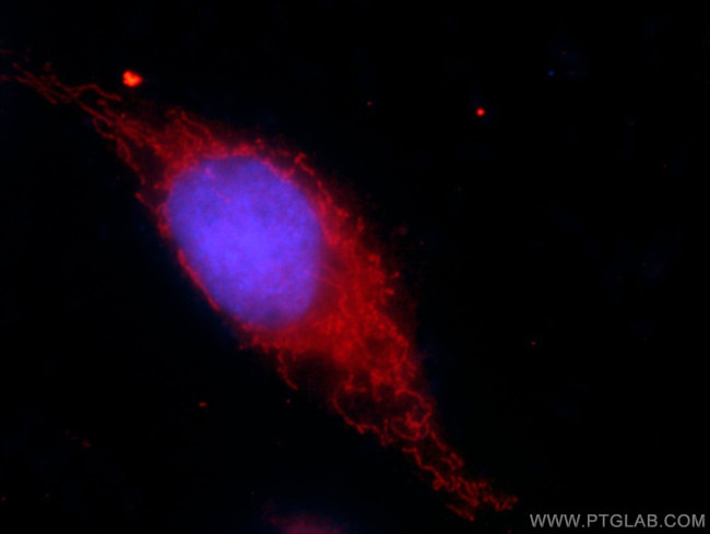 RPL3 Antibody in Immunocytochemistry (ICC/IF)