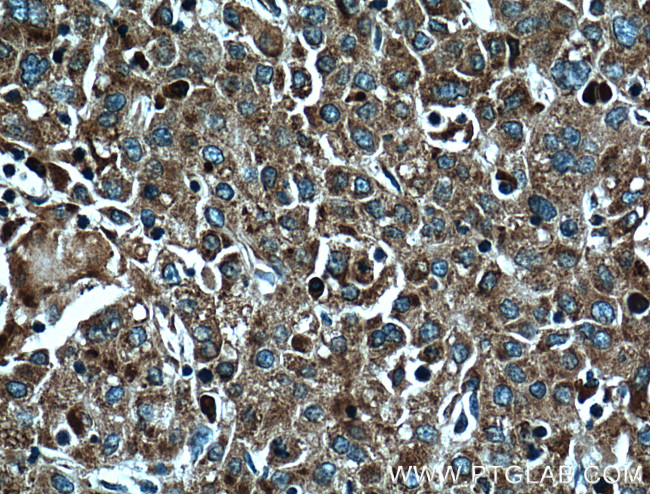 RPL3 Antibody in Immunohistochemistry (Paraffin) (IHC (P))