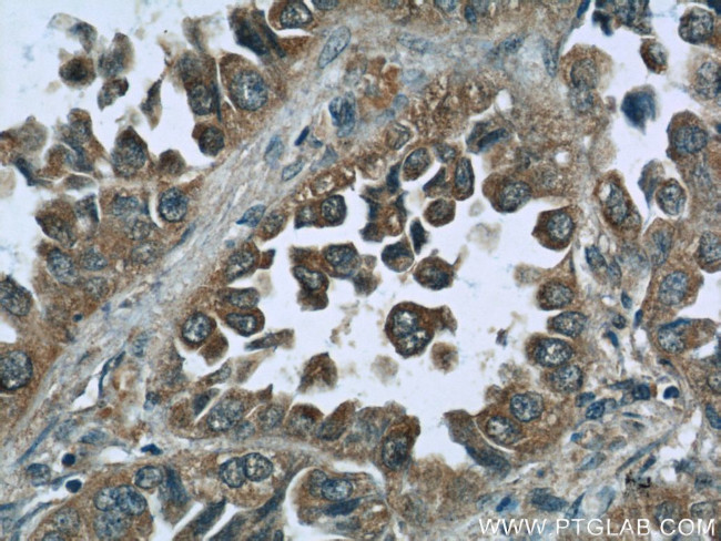 RPL3 Antibody in Immunohistochemistry (Paraffin) (IHC (P))