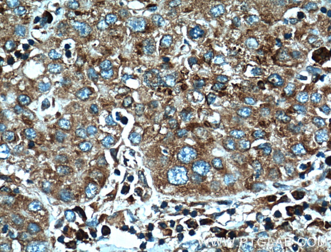 RPL3 Antibody in Immunohistochemistry (Paraffin) (IHC (P))